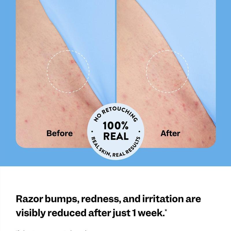 Sorrae Glow Smooth: Ingrown Hair Treatment